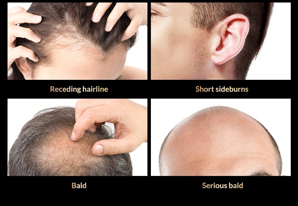 Anti Hair Loss And Growth Spray Oil For Men Women Anti Hair Loss And Growth Spray Oil For Men Women