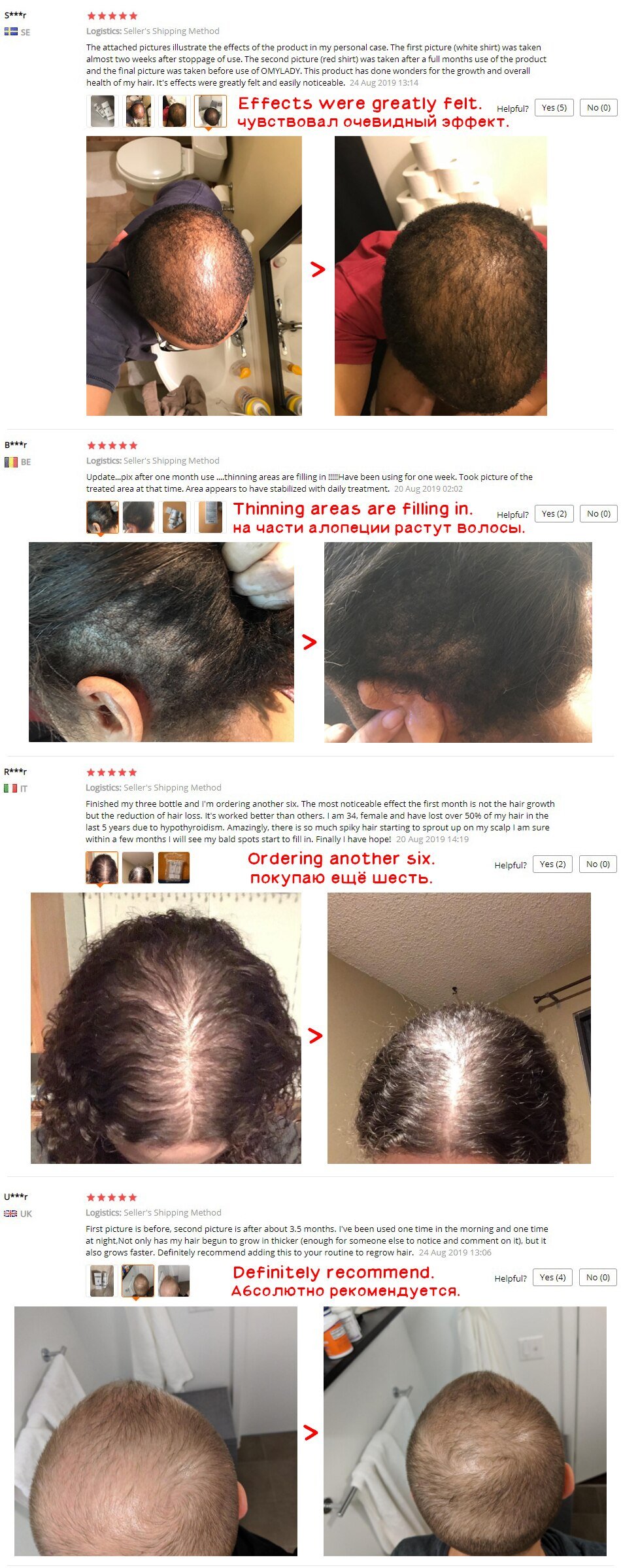 Anti Hair Loss And Growth Spray Oil For Men Women Anti Hair Loss And Growth Spray Oil For Men Women