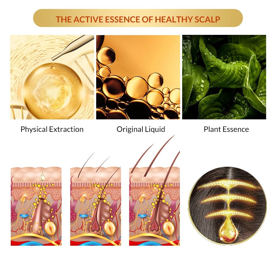 Anti Hair Loss And Growth Spray Oil For Men Women Anti Hair Loss And Growth Spray Oil For Men Women