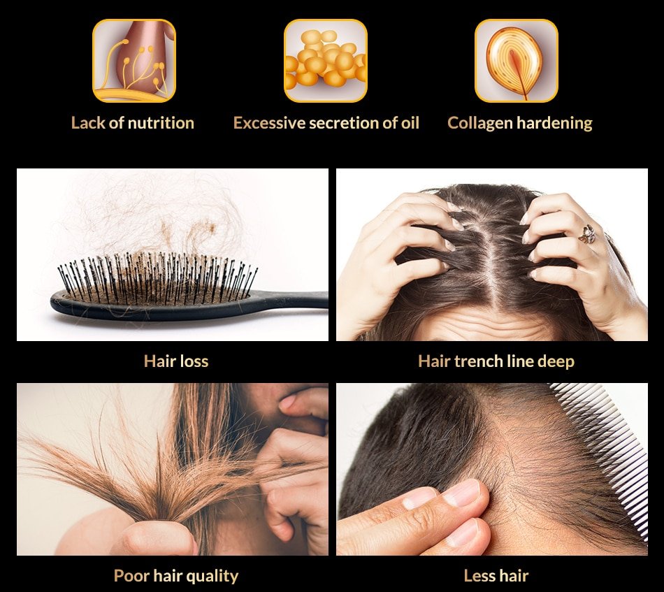 Anti Hair Loss And Growth Spray Oil For Men Women Anti Hair Loss And Growth Spray Oil For Men Women
